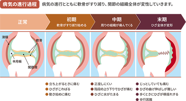 病期の進行過程