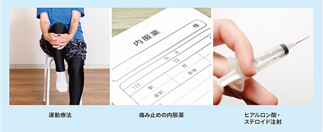 運動療法　痛み止めの内服薬　ヒアルロン酸・ステロイド注射